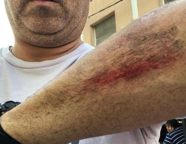 Un motociclista cayó al pavimento al patinar por la acumulación de excremento de aves