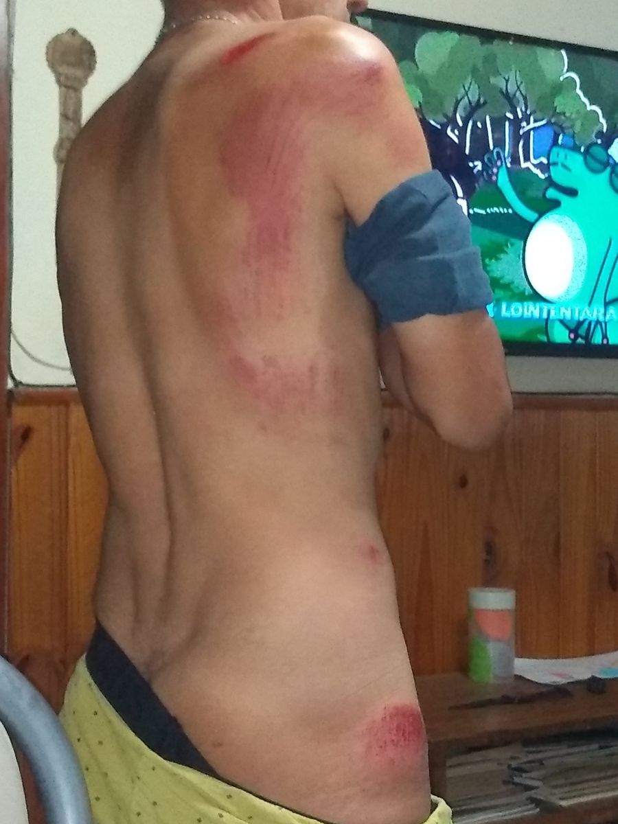 Declaraciones de uno de los ciclistas accidentados en la Pista de Salud: apuntó contra Gatica